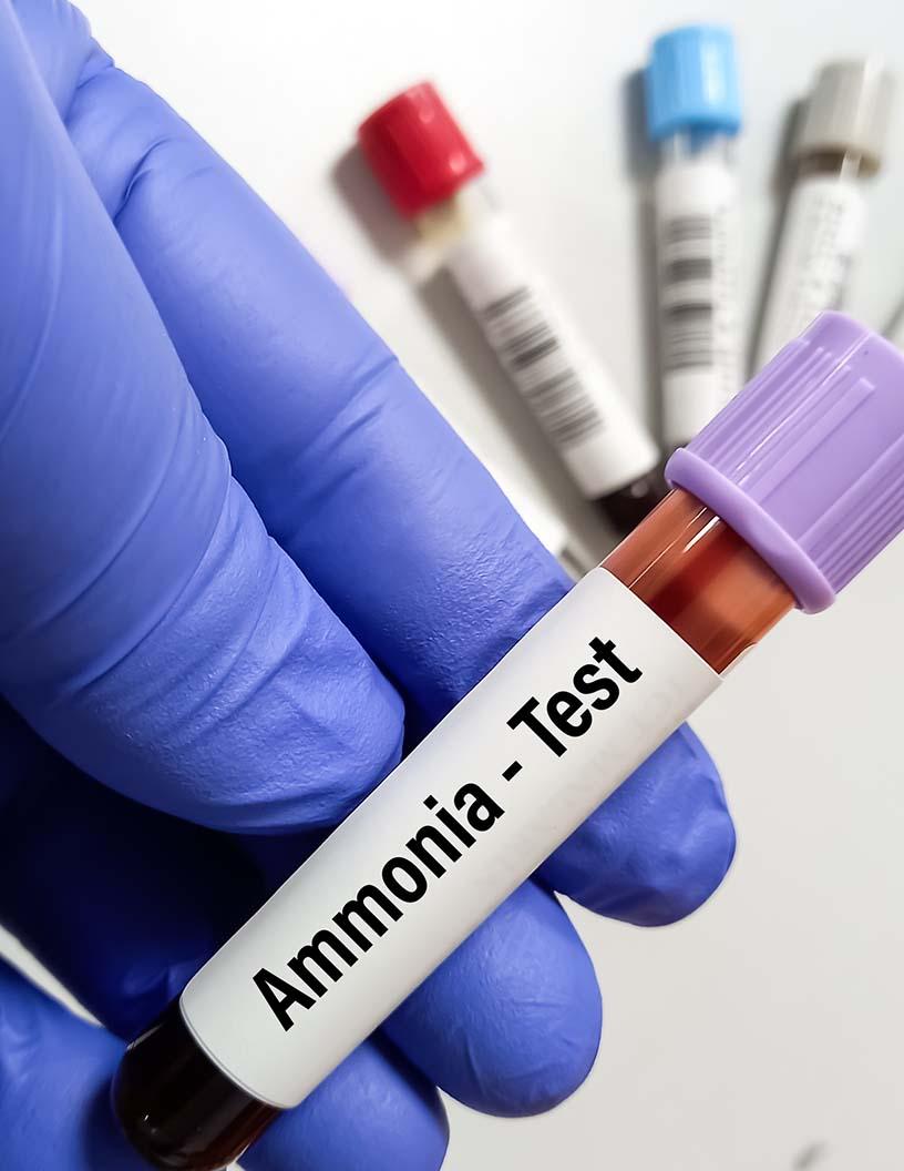 Urea Cycle Disorder Treatment Market Analysis, Size, and Forecast 2025-2029: North America (US and Canada), Europe (France, Germany, Italy, and UK), Middle East and Africa (South Africa), APAC (China, India, and Japan), and Rest of World (ROW)