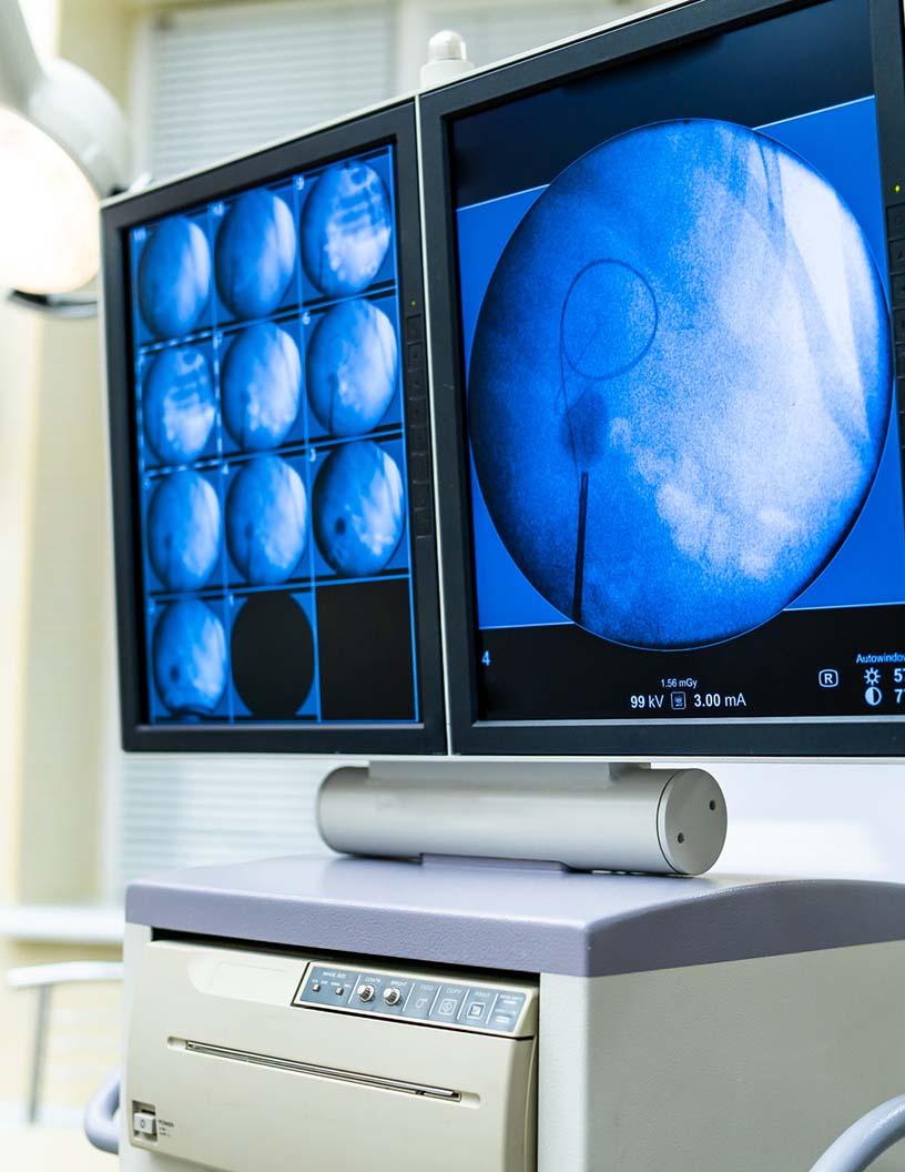 US Medical Display Monitors Market Analysis, Size, and Forecast 2025-2029