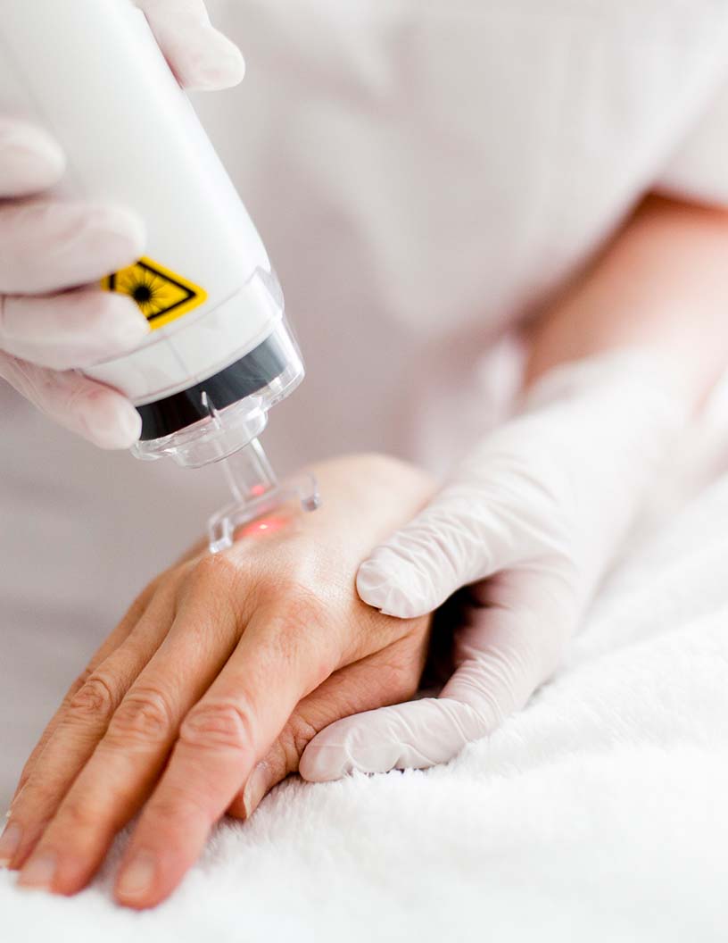 Dermatology Lasers Market Analysis North America, Europe, Asia, Rest of World (ROW) - US, Germany, UK, China, India - Size and Forecast 2024-2028
