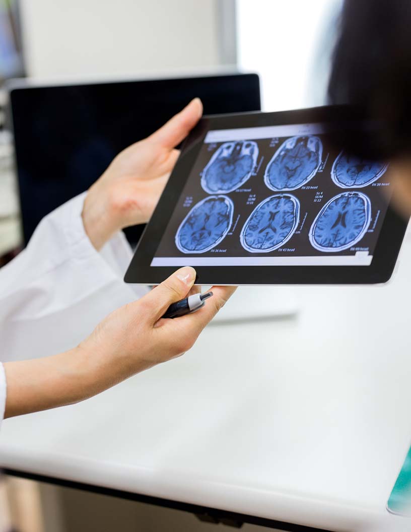 Neurodiagnostics Market Analysis North America, Europe, Asia, Rest of World (ROW) - US, Germany, UK, China, Japan - Size and Forecast 2024-2028