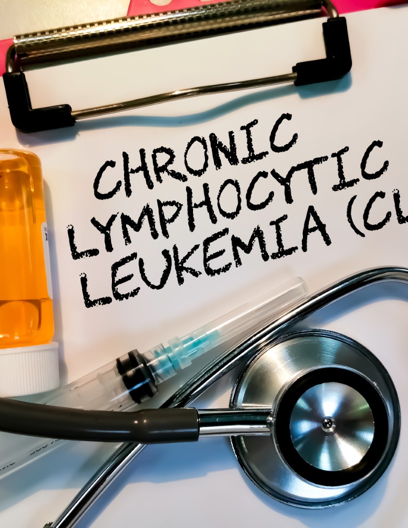 Chronic Lymphocytic Leukemia (CLL) Therapeutics Market Analysis North America, Europe, Asia, Rest of World (ROW) - US, Germany, UK, China, Japan - Size and Forecast 2024-2028
