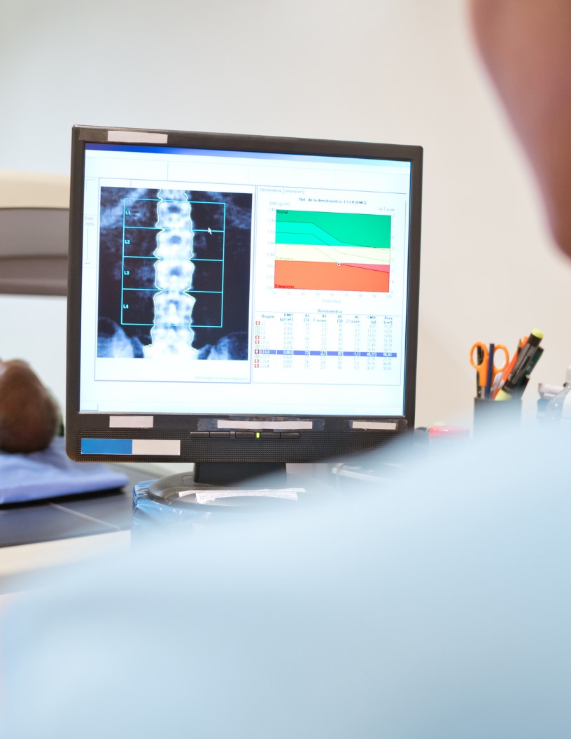 Bone Densitometer Market Analysis North America, Europe, Asia, Rest of World (ROW) - US, UK, Germany, China, Japan - Size and Forecast 2024-2028