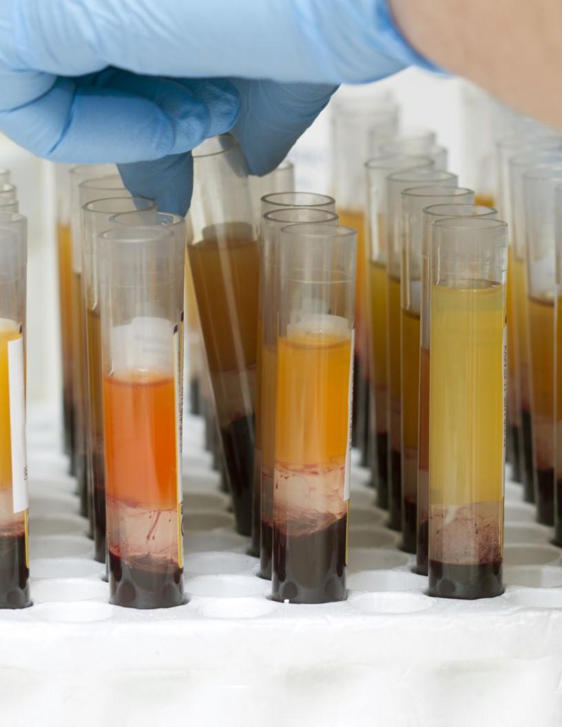 Blood Plasma Market Analysis North America, Europe, Asia, Rest of World (ROW) - US, Germany, France, China, Canada, UK, Japan, Brazil, India, Italy - Size and Forecast 2024-2028