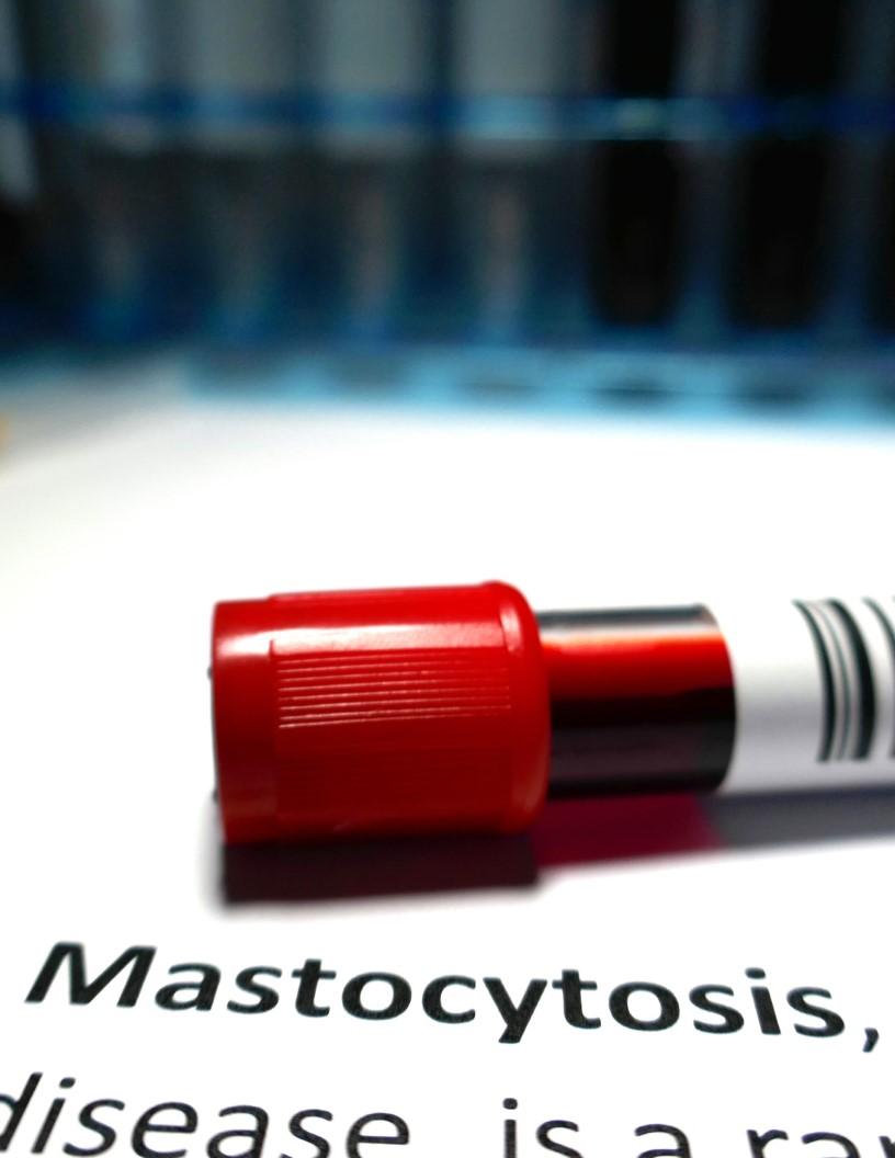 Systemic Mastocytosis Treatment Market Analysis, Size, and Forecast 2025-2029: North America (US, Canada, and Mexico), Europe (France, Germany, Italy, and UK), APAC (China, India, and Japan), and Rest of World (ROW)