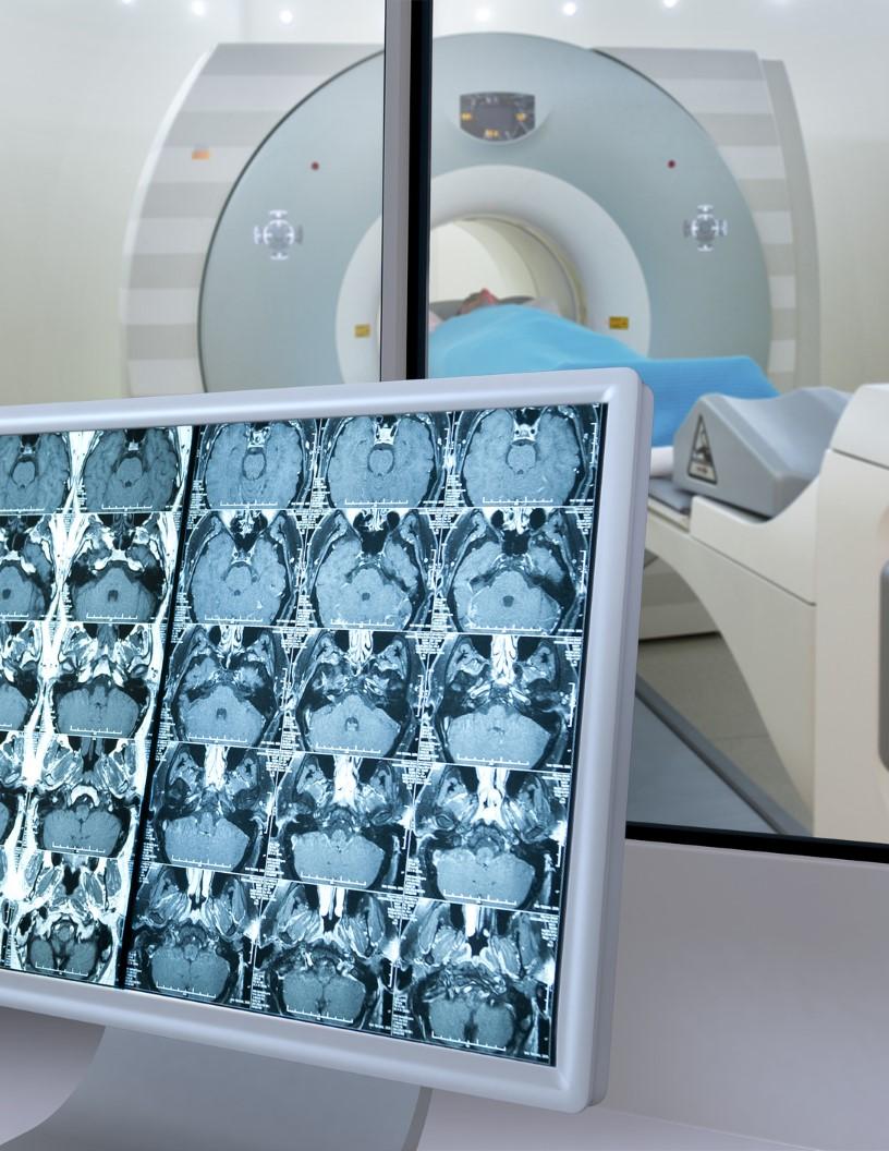 Clinical Trial Imaging Market Analysis North America, Europe, Asia, Rest of World (ROW) - US, China, Germany, UK, Japan, India, France, Canada, Australia, Brazil - Size and Forecast 2024-2028