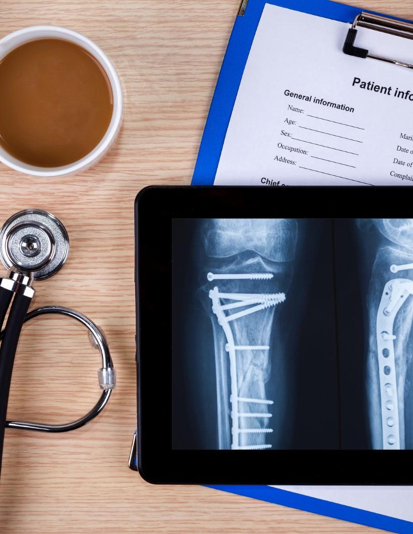 Demineralized Bone Matrix Market Analysis North America, Europe, Asia, Rest of World (ROW) - US, UK, China, Germany, Canada, Japan, France, Brazil, Italy, South Korea - Size and Forecast 2025-2029