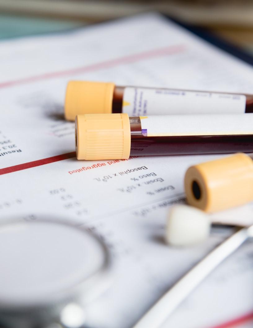 Blood Collection Market Size- North America, Europe, Asia, Rest of World (ROW) - US, China, Germany, UK, France, Spain, Japan, India, Australia, Brazil - Trends and Forecast Report 2025-2029