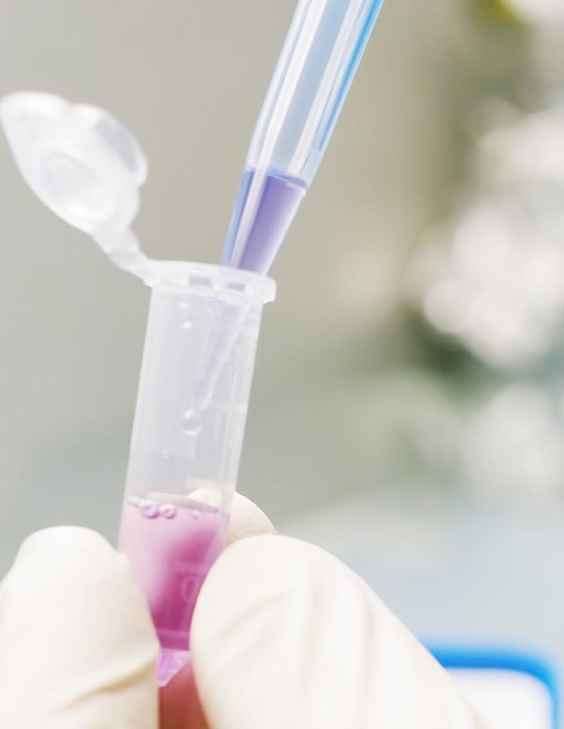 RNA Extraction And Purification Market Analysis North America, Europe, Asia, Rest of World (ROW) - US, Germany, China, UK, Japan, France, Canada, South Korea, India, Italy - Size and Forecast 2025-2029