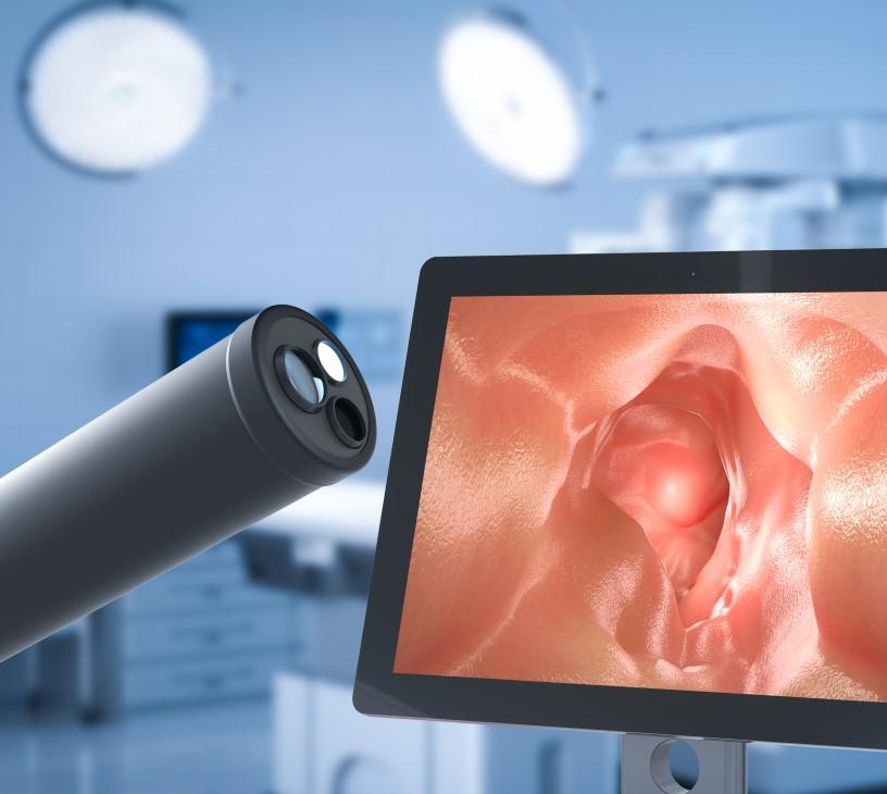 AI In Endoscopy Market Analysis, Size, and Forecast 2025-2029: North America (US and Canada), Europe (France, Germany, and UK), APAC (Australia, China, India, Japan, and South Korea), and Rest of World (ROW)
