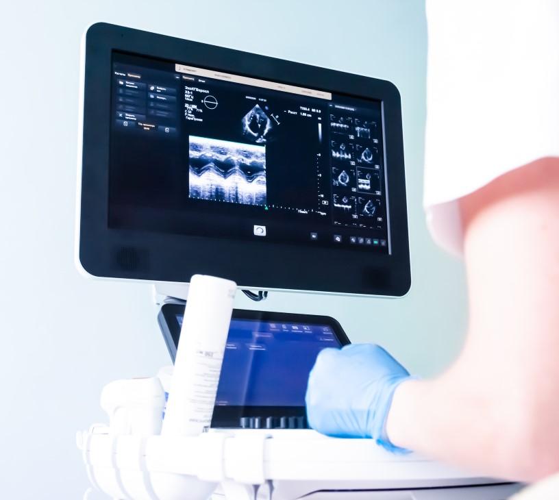 AI In Ultrasound Imaging Market Analysis, Size, and Forecast 2025-2029: North America (US, Canada, and Mexico), Europe (France, Germany, Italy, and UK), APAC (China, India, and Japan), and Rest of World (ROW)