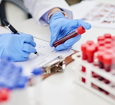 Interleukin Inhibitors Market by Product and Geography - Global Forecast and Analysis 2019-2023