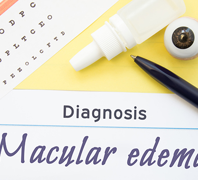 Macular Edema - A Pipeline Analysis Report