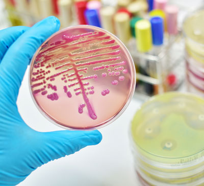 Global Industrial Microbiology Market 2018-2022
