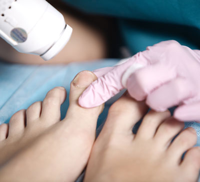 Global Podiatry Lasers Market 2018-2022