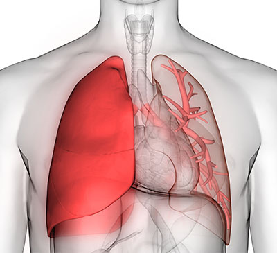 Pulmonary Embolism - A Pipeline Analysis Report