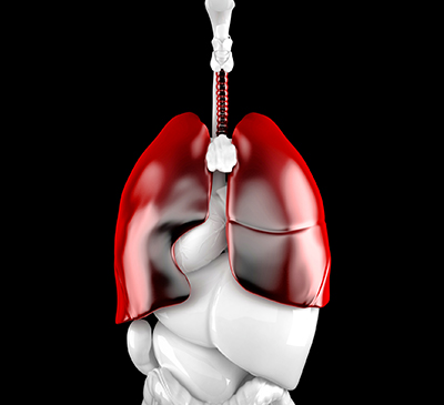 Pulmonary Arterial Hypertension - A Pipeline Analysis Report