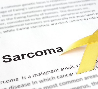 Rhabdomyosarcoma - A Pipeline Analysis Report