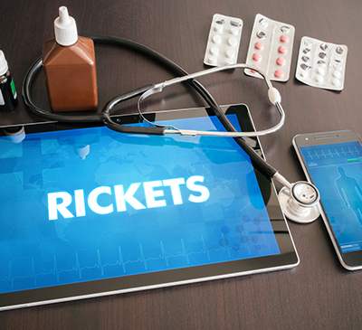 Global Rickets Treatment Market 2019-2023