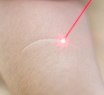 Scar Therapeutics - A Pipeline Analysis Report