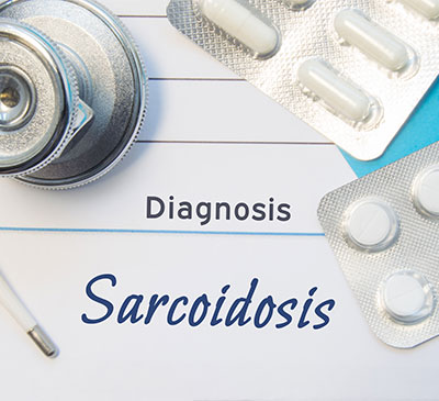 Sarcoidosis - A Pipeline Analysis Report