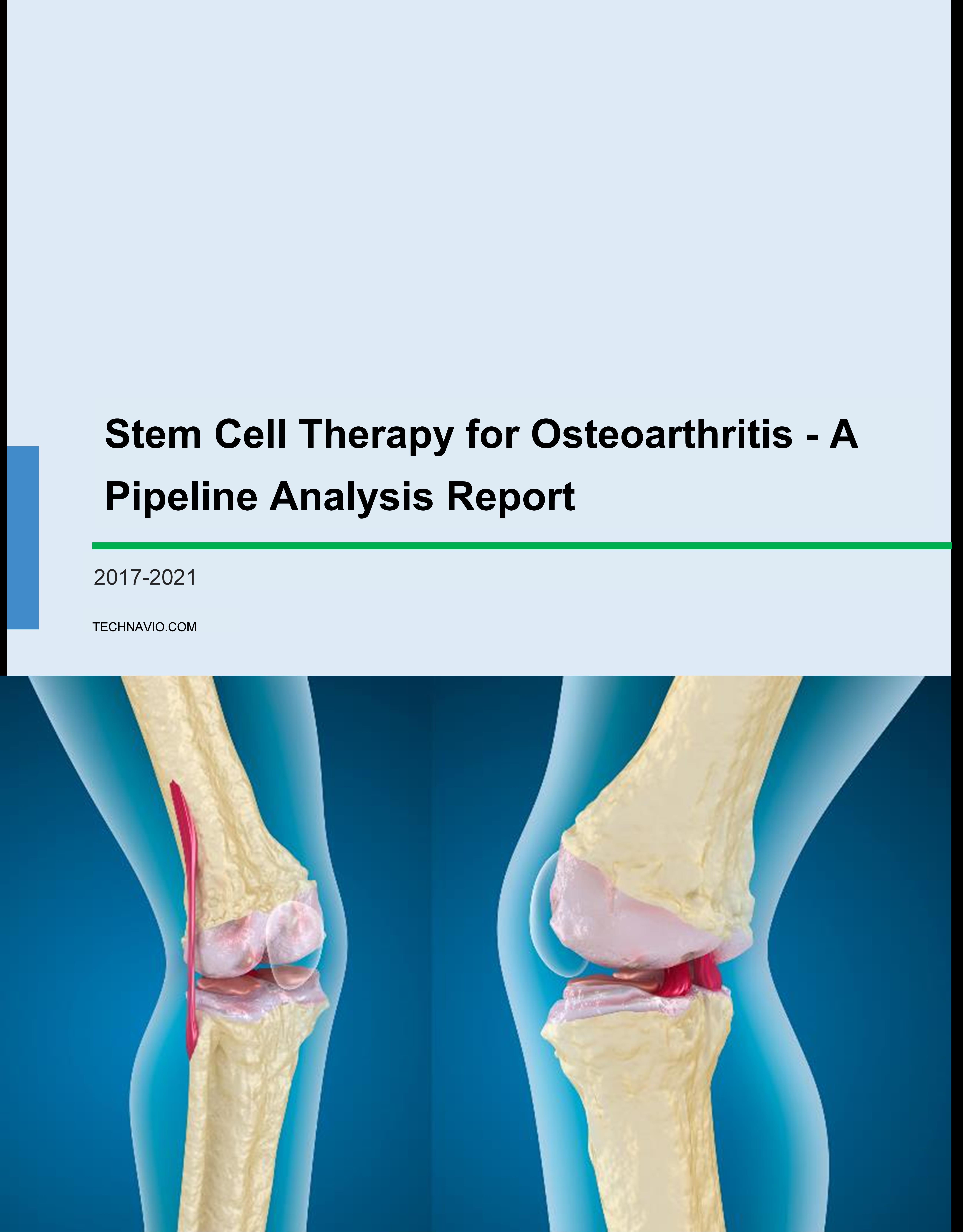 Stem Cell Therapy for Osteoarthritis - A Pipeline Analysis Report
