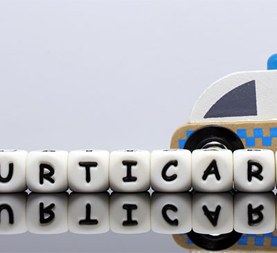 Urticaria - A Pipeline Analysis Report