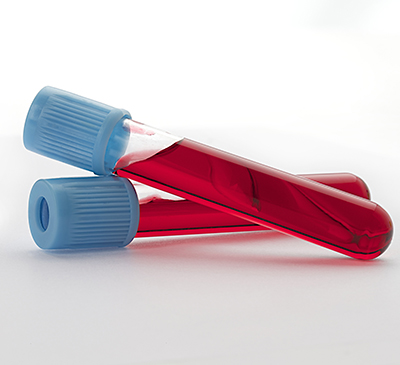 Contrast Injectors Market by Product and Geography - Forecast and Analysis 2021-2025