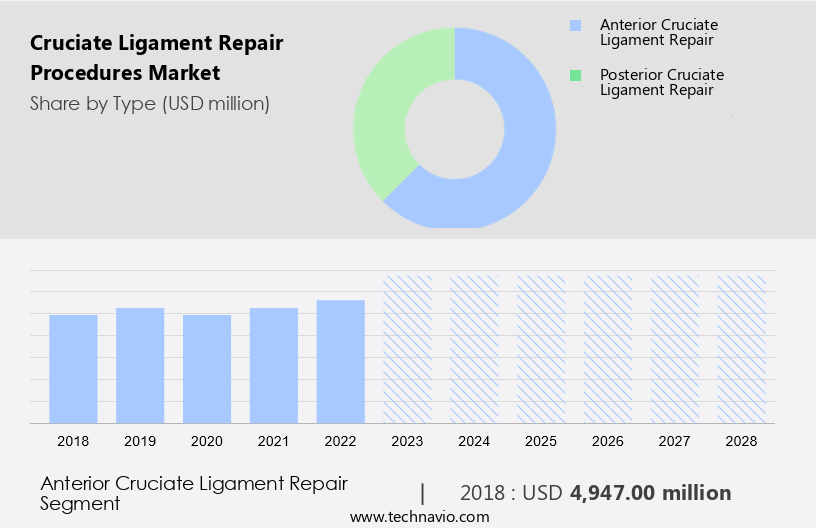 Cruciate Ligament Repair Procedures Market Size
