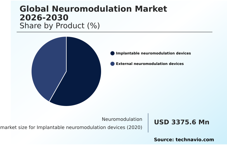 Foundry Equipment Market Size