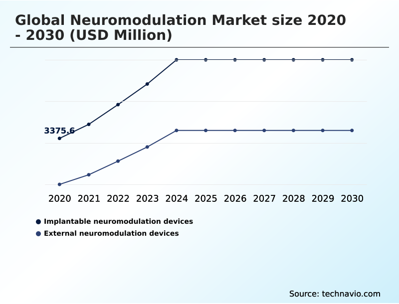 Foundry Equipment Market Size