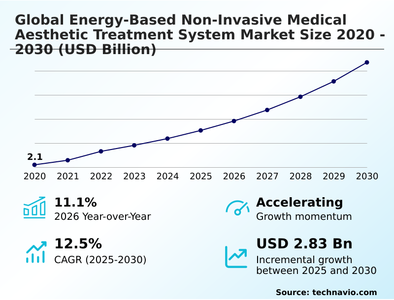 Foundry Equipment Market Size