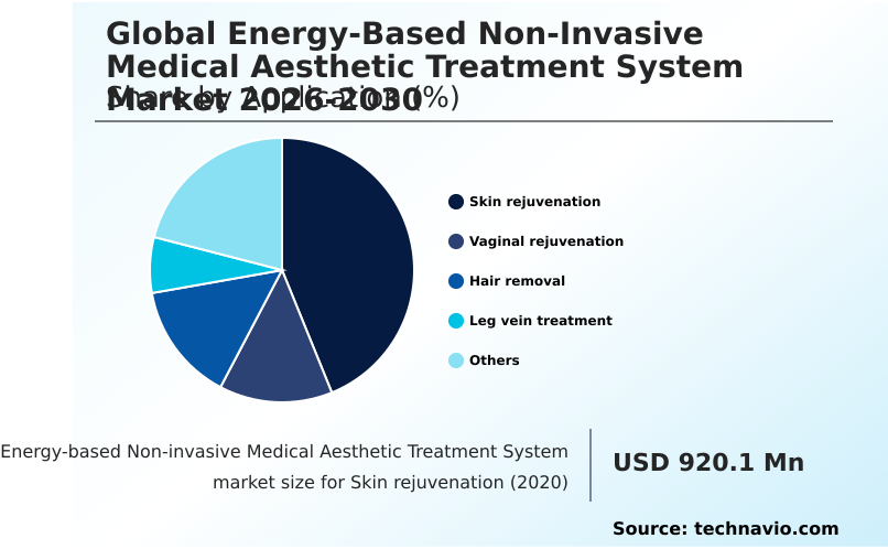 Foundry Equipment Market Size