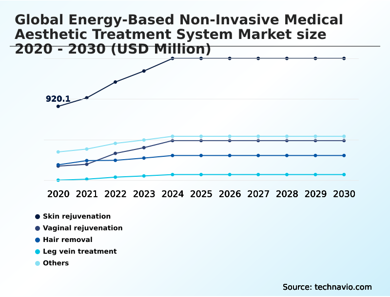 Foundry Equipment Market Size