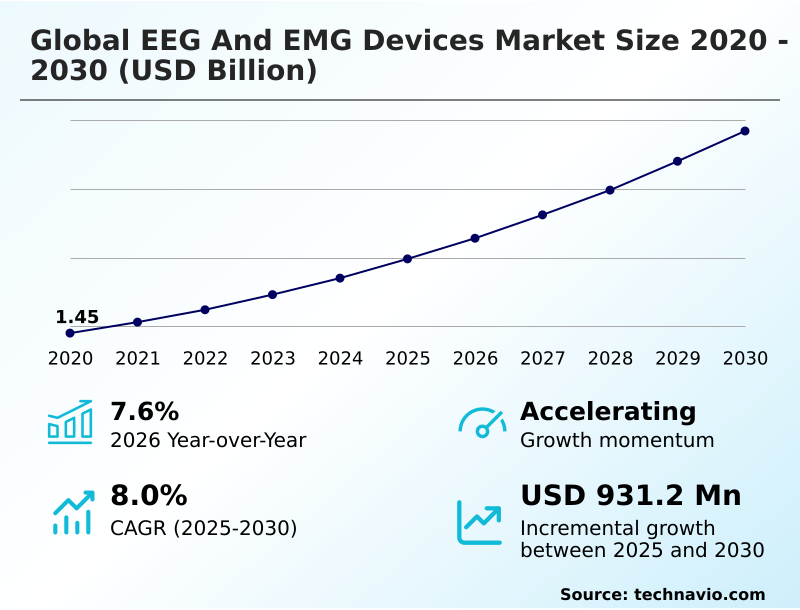 Foundry Equipment Market Size