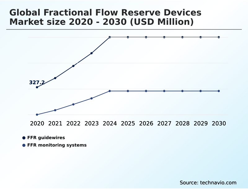 Foundry Equipment Market Size