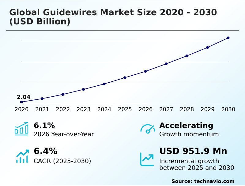 Foundry Equipment Market Size
