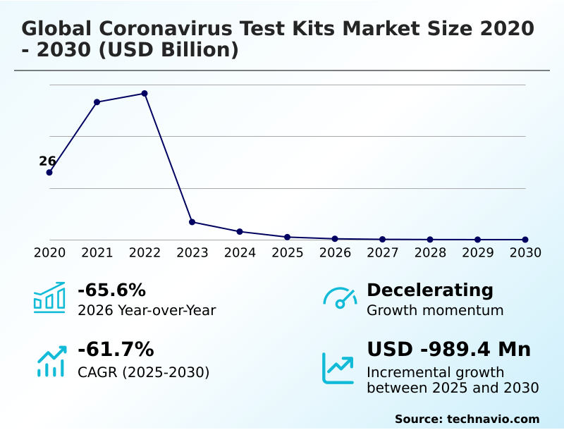 Foundry Equipment Market Size