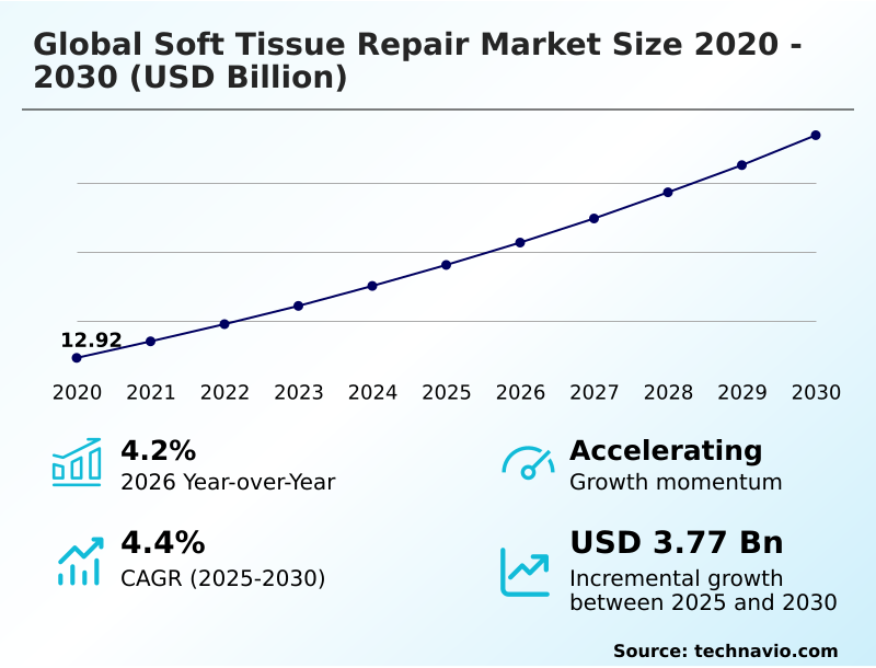 Foundry Equipment Market Size