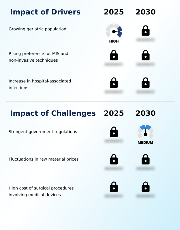 Foundry Equipment Market Size