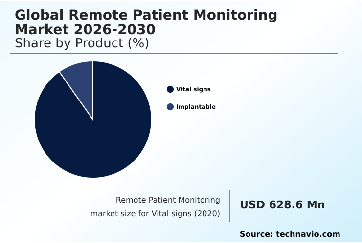 Foundry Equipment Market Size