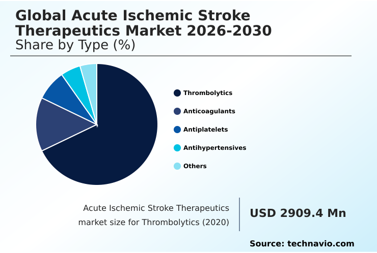 Foundry Equipment Market Size