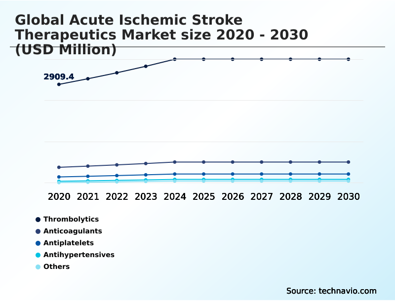 Foundry Equipment Market Size