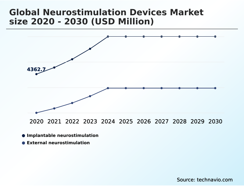 Foundry Equipment Market Size