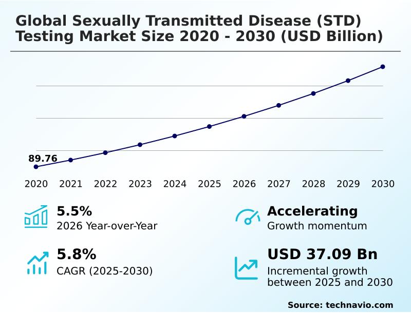 Foundry Equipment Market Sizeeeeee