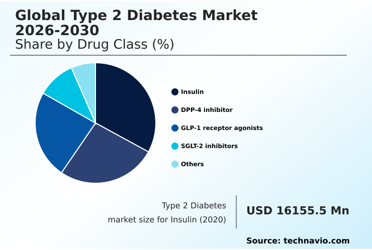 Foundry Equipment Market Size