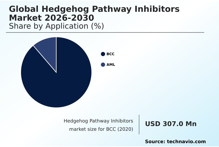 Foundry Equipment Market Size