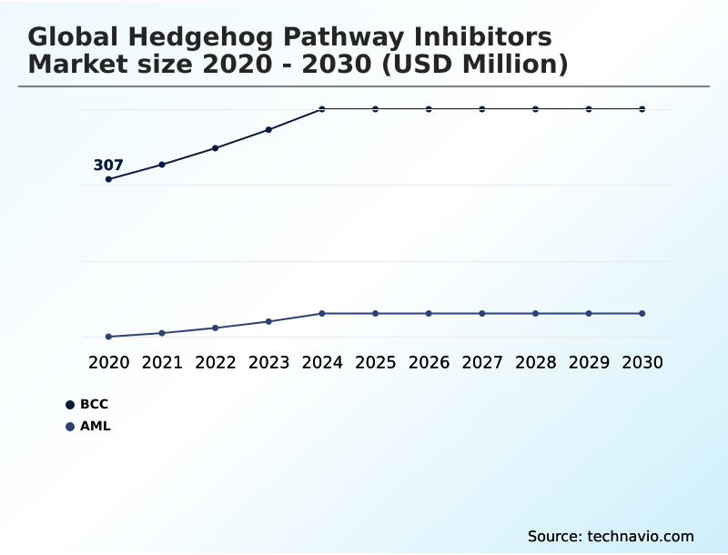 Foundry Equipment Market Size