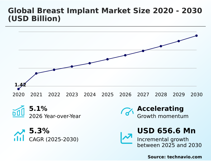 Foundry Equipment Market Size