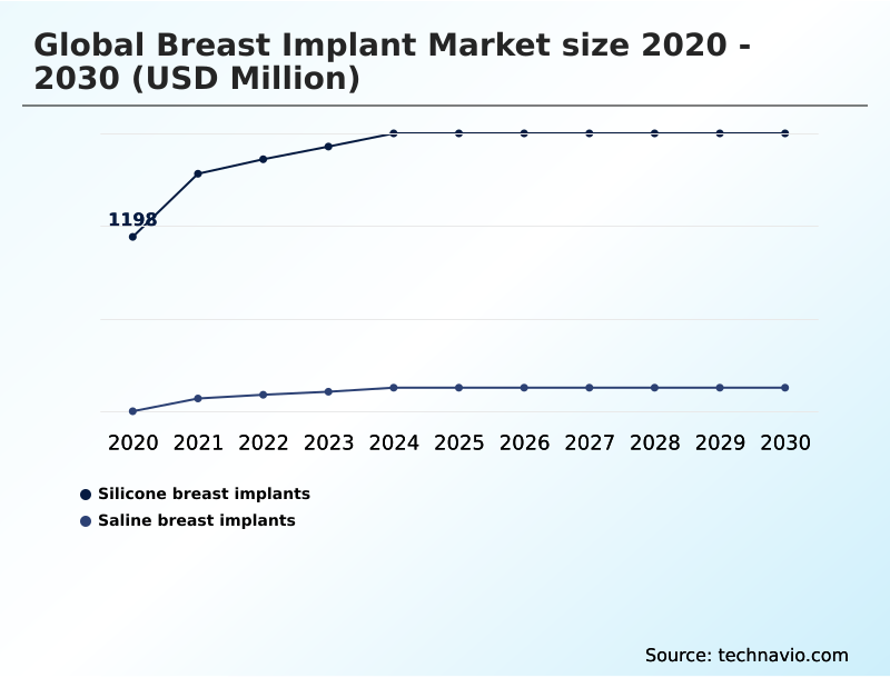 Foundry Equipment Market Size