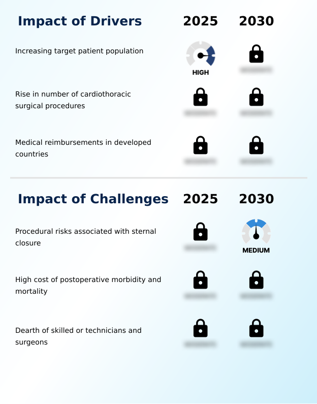 Foundry Equipment Market Size